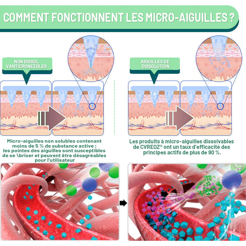 【Dernier jour de promotion : 60% DE RABAIS🏅】Cvreoz® Patch NANO de microaiguilles NIDDK-Tirzepatide pour maigrir et la santé (Sans douleur, libération 24h/24 et 7j/7 | Perd 9 kg RAPIDEMENT | Réduction de 90% du sucre | )🔴03